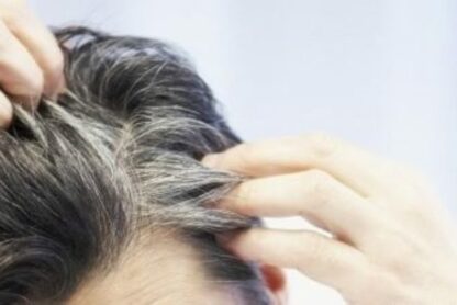 Capelli bianchi